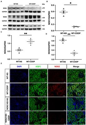 Deletion of NADPH oxidase 2 attenuates cisplatin-induced acute kidney injury through reducing ROS-induced proximal tubular cell injury and inflammation